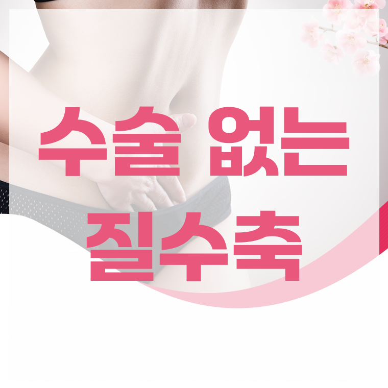 수술 없는 질수축